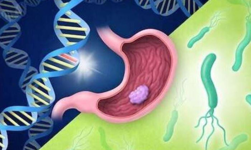 Berberine for HP Bacteria and + 5 A Natural Solution for Gastrointestinal Health